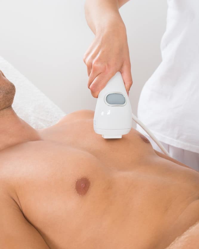 Epilation laser du torse ou du dos